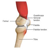 Osgood-Schlatter Disease